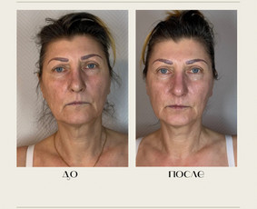 Kosmetologė - Veido masažas - 4 Veido masažas - Kosmetologė - 4