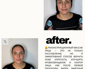 Kosmetologė - Veido masažas - 3 Veido masažas - Kosmetologė - 3