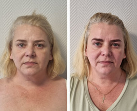 Kosmetologė - Veido masažas - 2 Veido masažas - Kosmetologė - 2