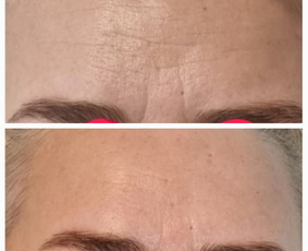 Kosmetologė - Veido masažas - 1 Veido masažas - Kosmetologė - 1