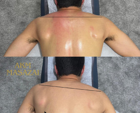 Masažo paslaugos - Padovanokite sau sveikatą ir atsipalaidavimą - 3
