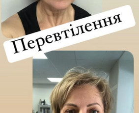 Масаж - Veido masažas - 1 Veido masažas - Масаж - 1