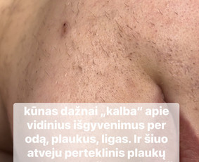 Elektroepiliacija Šiauliuose - Kosmetologės - 3 Kosmetologės - Elektroepiliacija Šiauliuose - 3