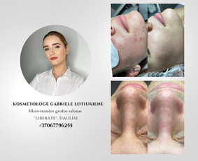 Med. kosmetologė Gabrielė Lotiukienė, Šiauliuose - Kosmetologo konsultacija - 1 Kosmetologo konsultacija - Med. kosmetologė Gabrielė Lotiukienė, Šiauliuose - 1