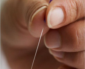 Sveikata, gydymas - Akupunktūra - 3