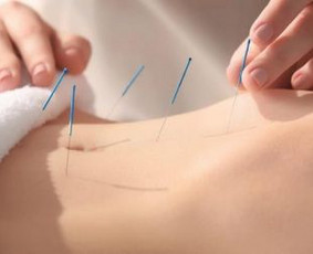 Sveikata, gydymas - Akupunktūra - 2