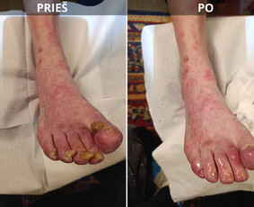 Grožio paslaugos - Probleminių nagų bei padų tvarkymas jūsų namuose - 3