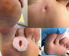 Pedikiūras - Same Place Beauty Academy Instruktorė - 2