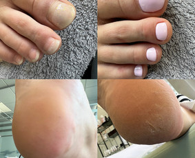 Pedikiūras - Same Place Beauty Academy Instruktorė - 1