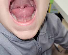 Vaikų kalbos sutrikimų korekcija - Logopedė Ieva - 1