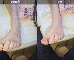Probleminių nagų, padų, nuospaudų,varkymas jūsų namuose / Aida / Darbų pavyzdys ID 4193445