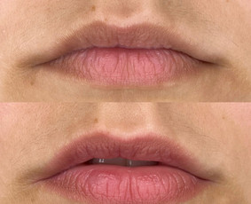 Grožio paslaugos - Kristina Nalevaikienė Perla Muter - 3