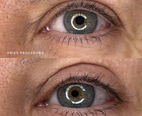 Grožio paslaugos - Kristina Nalevaikienė Perla Muter - 4