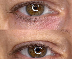 Akių permanentinis makiažas - Kristina Nalevaikienė Perla Muter - 4