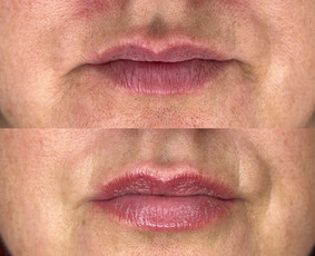 Lūpų permanentinis makiažas - Kristina Nalevaikienė Perla Muter - 3