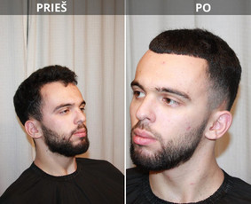 Barzdos formavimas - Kirpimo paslaugos su i&scaron;kvietimu į namus Vilniuje. - 3