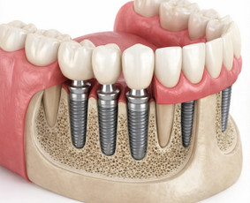Banerių kūrimas - Spauda, dizainas, reklama - 1