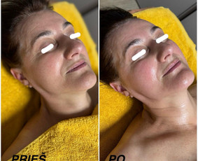 Kosmetologės - Kobido masažas - 4