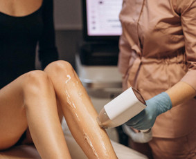 Kosmetologės - Lazerinė depiliacija vyrams ir moterims Kaunas - 1