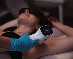 Kosmetologės - Lazerinė depiliacija vyrams ir moterims Kaunas - 3