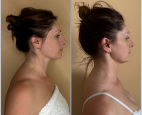 Masažo paslaugos - Veido masažas - 4