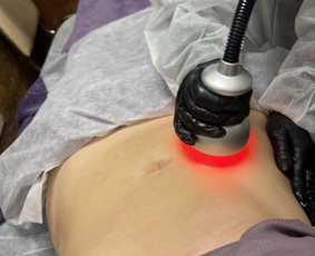 Anticeliulitinis masažas - Limfodrenažo masažai celiulito mažinimui - 4