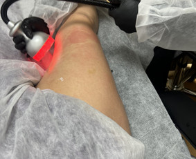 Anticeliulitinis masažas - Limfodrenažo masažai celiulito mažinimui - 3