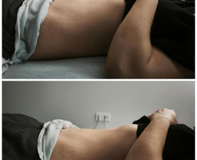 Limfodrenažinis masažas - Pajauskite malonumą būti savo kūne! - 1