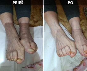 Grožio paslaugos - Probleminių nagų bei padų tvarkymas jūsų namuose - 1