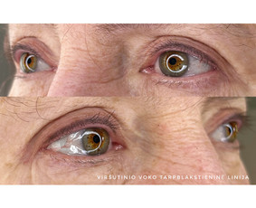 Akių permanentinis makiažas - Kristina Nalevaikienė Perla Muter - 3