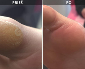 Manikiūro ir pedikiūro paslaugos! / DŽANETA / Darbų pavyzdys ID 4307365