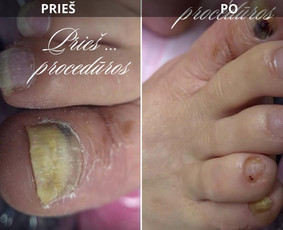 Manikiūro ir pedikiūro paslaugos! / DŽANETA / Darbų pavyzdys ID 4307367