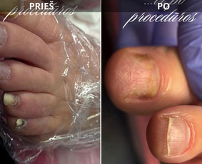 Manikiūro ir pedikiūro paslaugos! / DŽANETA / Darbų pavyzdys ID 4307369