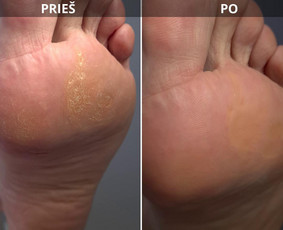 Pedikiūras vyrams - Manikiūro ir pedikiūro paslaugos! - 1