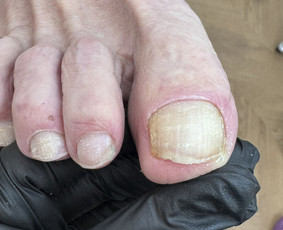 Manikiūras - Probleminių pėdų bei nagų tvarkymas / pedikiūras - 1