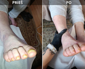 Manikiūras - Probleminių nagų, padų, nuospaudų,varkymas jūsų namuose - 1