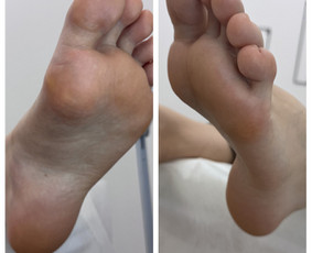 Manikiūras - Probleminių pėdų bei nagų tvarkymas / pedikiūras - 4