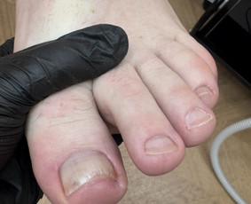 Manikiūras - Probleminių pėdų bei nagų tvarkymas / pedikiūras - 2