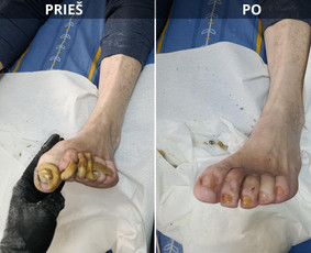 Grožio paslaugos - Probleminių nagų, padų, nuospaudų,varkymas jūsų namuose - 2