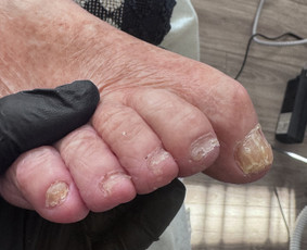 Manikiūras - Vykstu į namus, probleminių pėdų bei nagų tvarkymas - 1