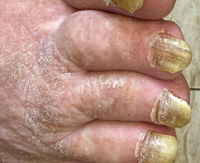 Manikiūras - Podologijos paslaugos - 1