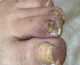 Manikiūras - Podologijos paslaugos - 2