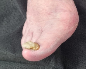 Manikiūras - Podologijos paslaugos - 3