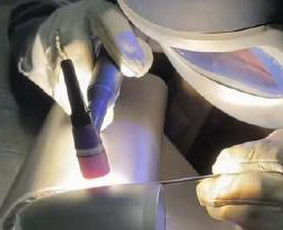 Aliuminio virinimas - Suvirinimo paslaugos. Tig, Mig/mag, Mma. - 1