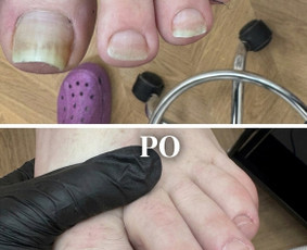 Grožio paslaugos - Vykstu į namus, probleminių pėdų bei nagų tvarkymas - 4