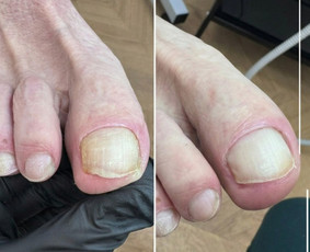 Grožio paslaugos - Vykstu į namus, probleminių pėdų bei nagų tvarkymas - 2