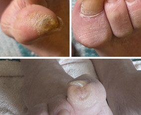 Grožio paslaugos - Vykstu į namus, probleminių pėdų bei nagų tvarkymas - 3