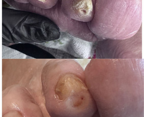 Grožio paslaugos - Vykstu į namus, probleminių pėdų bei nagų tvarkymas - 1