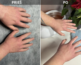 Bikini depiliacija - Kosmetologė - 1