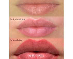 Lūpų permanentinis makiažas - Ilgalaikis makiažas/permanentas Vilniuje - 3